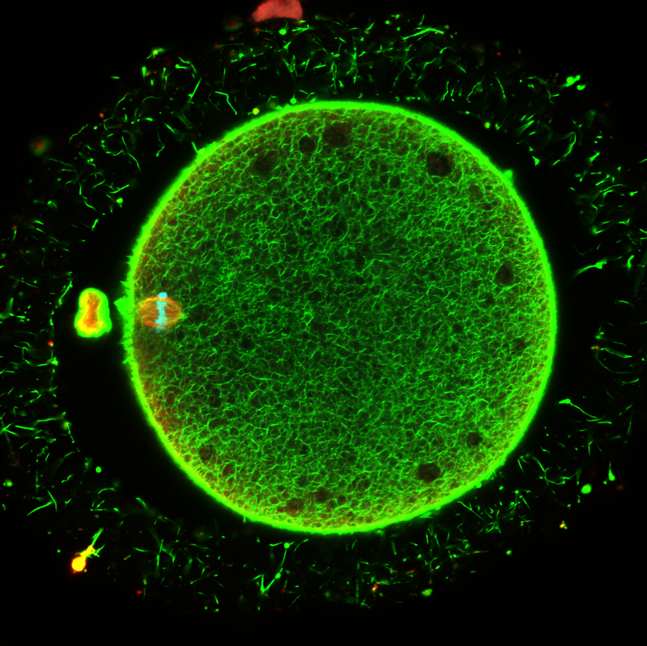 Immunofluorescence du fuseau et du  cytoplasme d’un ovocyte humain maturé in vitro après vitrification   permettant d’apprécier la préservation de la structure après application d’un protocole original de cryopréservation.