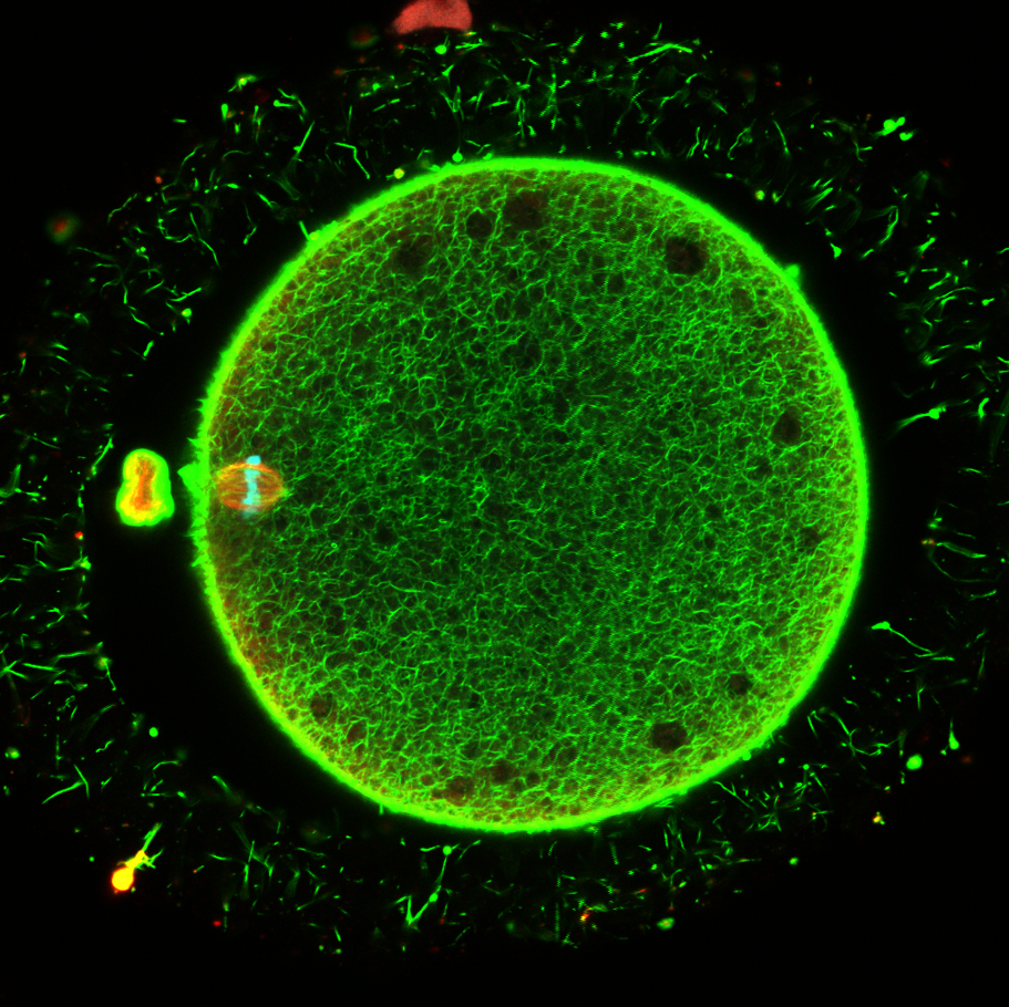 Spindle and Actin network Immunofluorescence of an in vitro matured human oocyte after vitrification allowing to assess structure preservation after undergoing an innovative cryopreservation protocol. 