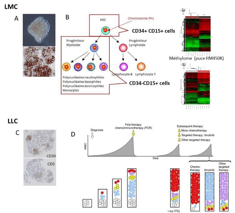 A et C : identification des cellules LMC et LLC dans les hématons medullaires. B: Démonstration de l’hétérogénéité épigénétique (méthylation de l’ADN) intra-clonale du clone LMC au diagnostic. D : Evolution génétique sub-clonale de la LLC selon les différ