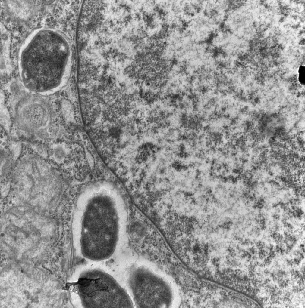 Persistance intracellulaire d’une bactérie CoPEC dans une cellule épithéliale intestinale humaine T84 après 24 heures d’infection. Observation en microscopie électronique à transmission (M2iSH, CICS-grossissement de 20 000 fois).