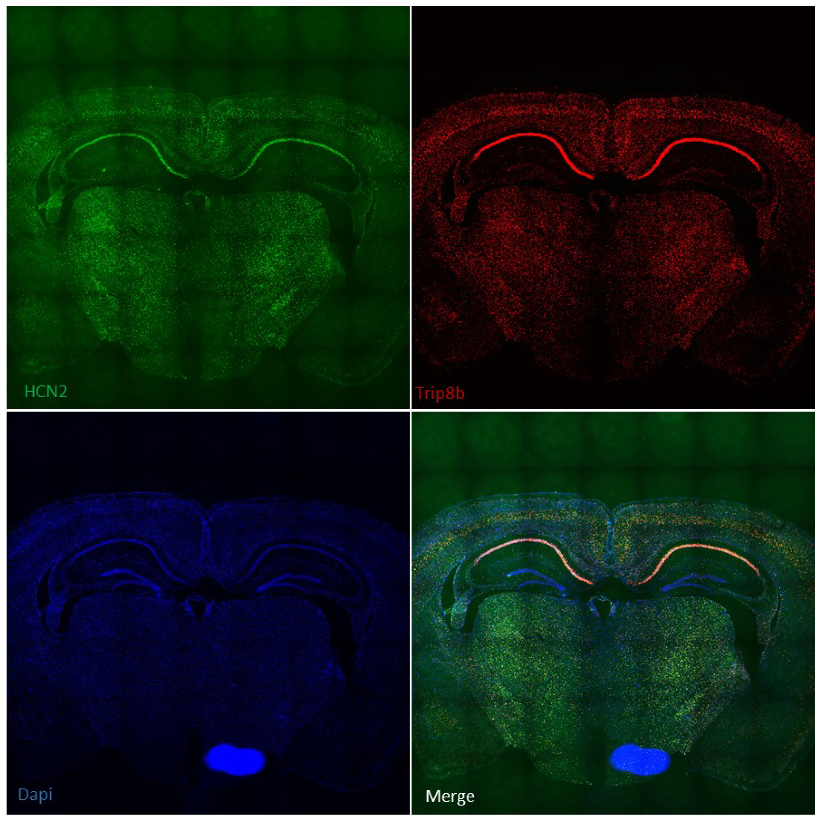 Marquage des transcrits HCN2 et TRIP8b sur coupe de cerveau de souris par technique RNAscope (X10, Y.Aissouni, NeuroDol)