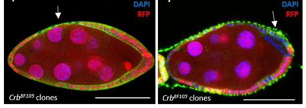 Exemple de cellules mutantes (RFP-) au destin différent selon l’environnement mécanique. A gauche elles s’aplatissent (diminution de la densité cellulaire). A droite, elles miment un début de développement tumoral (désorganisation, hyperprolifération).