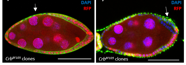 Example of mutant cells (RFP-) which harbor different defects depending on the mechanical environment. Left : the mutant cells flatten out (decrease in cell density). Right : these cells mimic tumor development (disorganization, hyperproliferation)